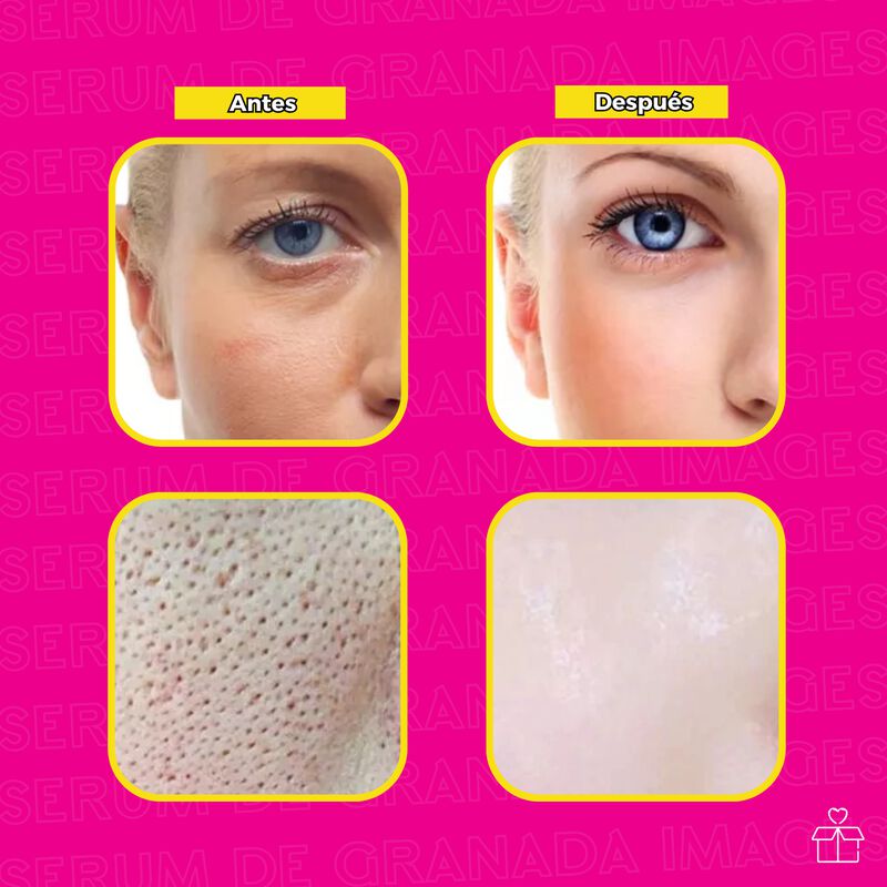 Sérum Granada Sérum Suero Hidratante Antimancha... image number null