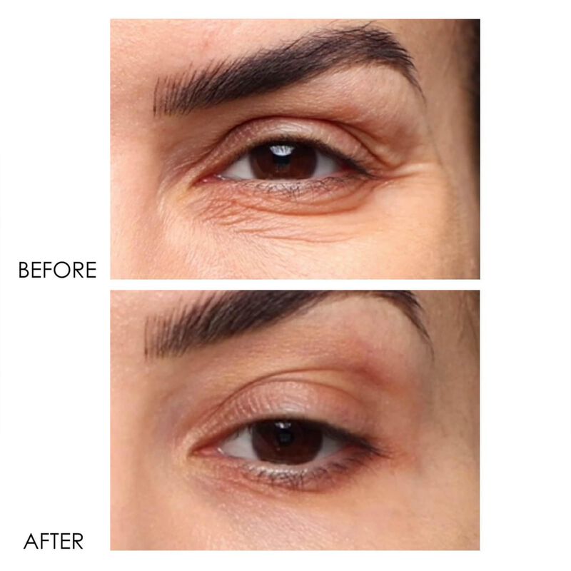 Crema Para Ojos Dermelect 15ml Revitalite image number null