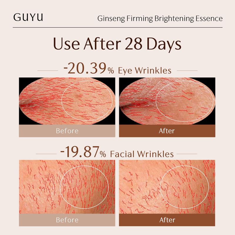Suero Guyu Ginseng Antienvejecimiento 30 Viales... image number null