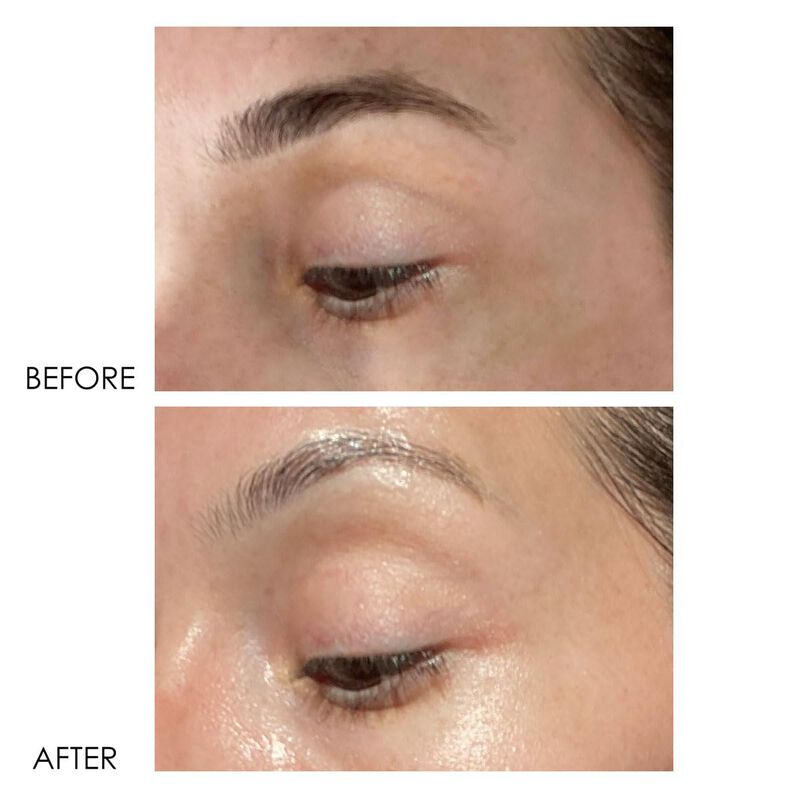 Crema Para Ojos Dermelect 15ml Revitalite image number null
