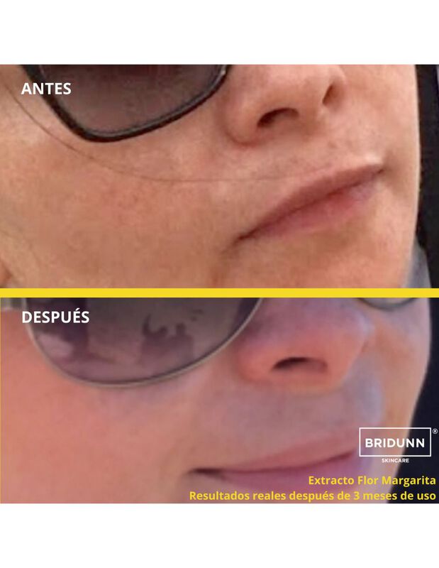 Crema Facial Anti Manchas BRIDUNN Despigmentant... image number null