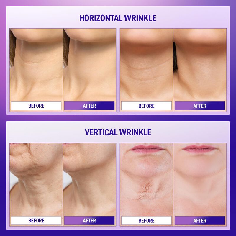 Crema Reafirmante Para El Cuello Ashania Korean... image number null
