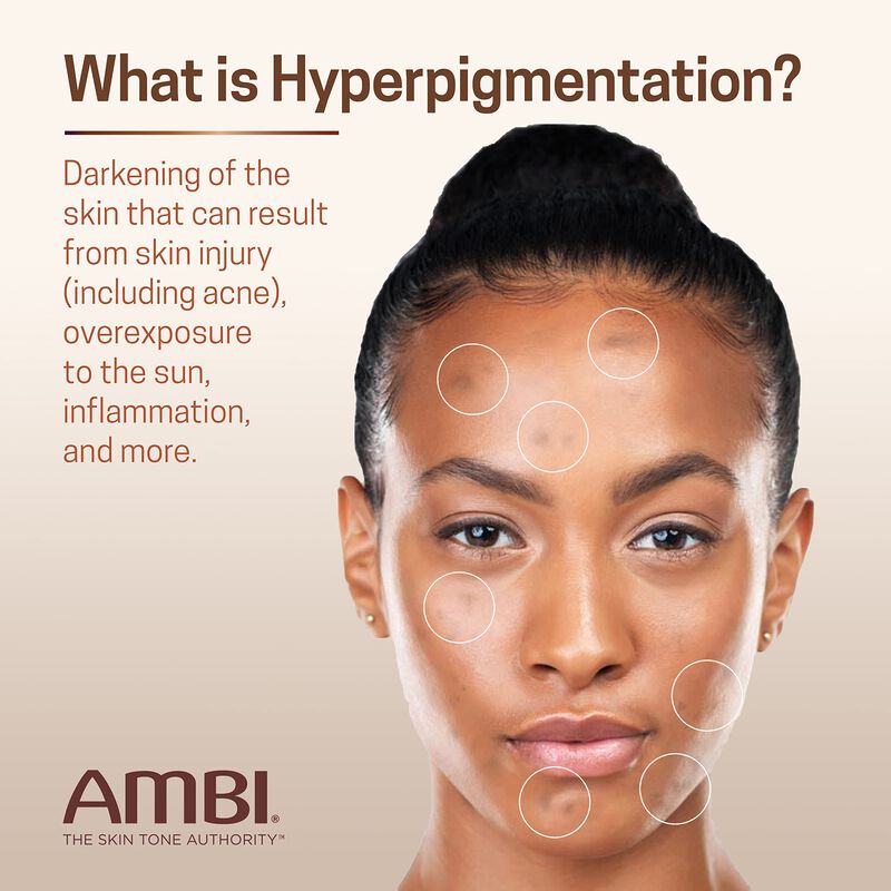 Crema Facial Ambi Even & Clear Advanced Para Hi... image number null