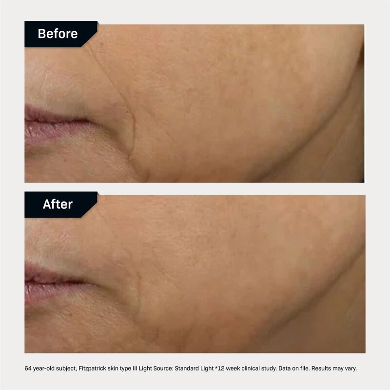 Crema Facial Moisturizer Revision Skincare D&middot;e&middot;... image number null