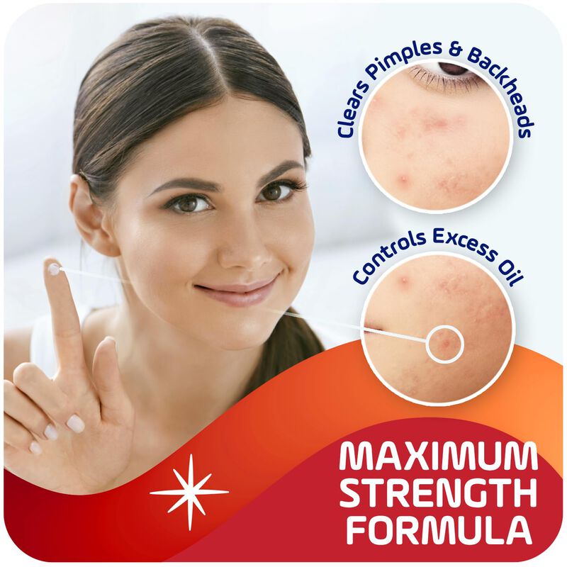 Crema De Tratamiento De Manchas De Acn&eacute; Con Ase... image number null