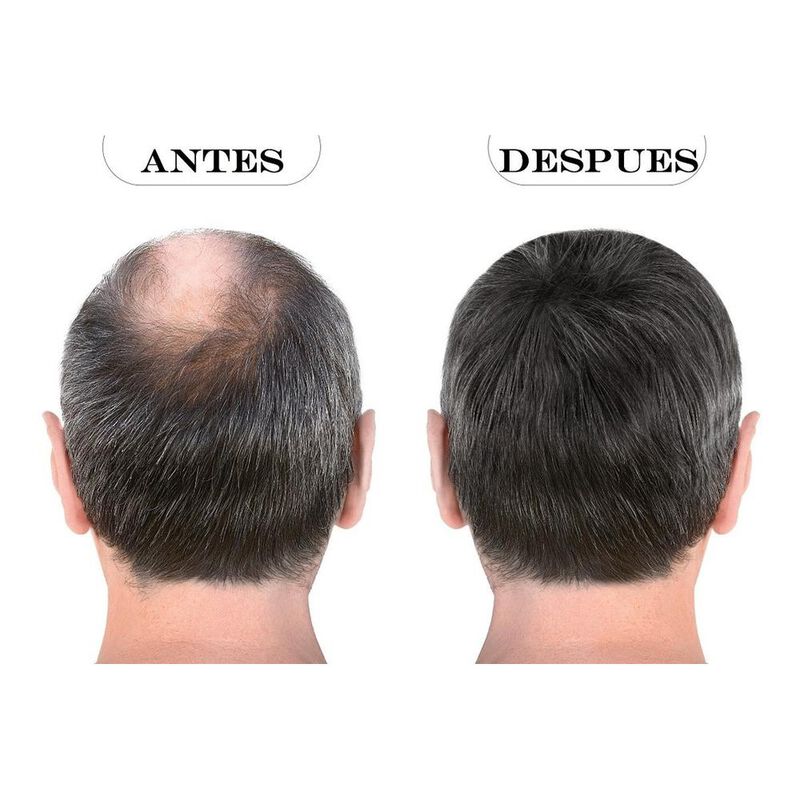 Kit Tratamiento Crecimiento Barba Y Cabello + R... image number null