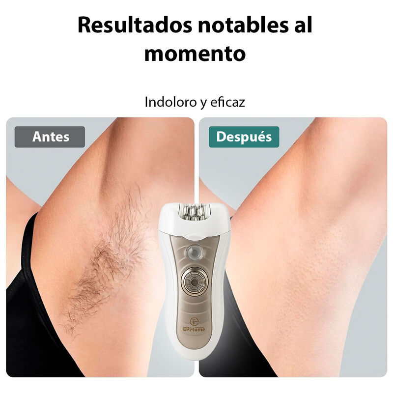 Depiladora Todo En Uno Epi Tome 2 Velocidades R... image number null