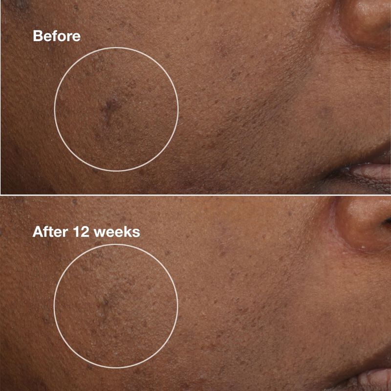 Crema Hidratante Clinique Even Better Clinical ... image number null