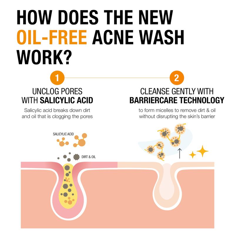 Limpiador Facial Neutrogena, Sin Aceite, Acn&eacute;, ... image number null