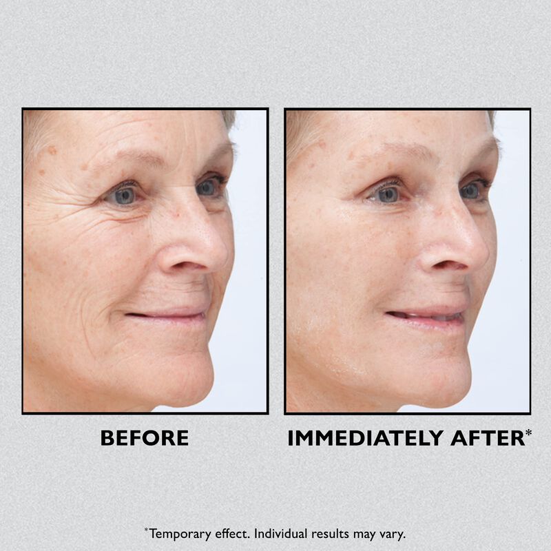 Estirador Facial Peter Thomas Roth Instant Firm... image number null