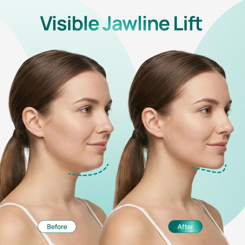 M&aacute;scara Facial Plantifique V-Line 15 Unidades c... image number null