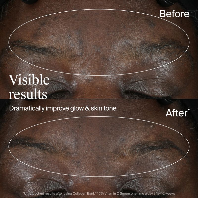 S&eacute;rum Facial Neutrogena Collagen Bank, 15% De V... image number null