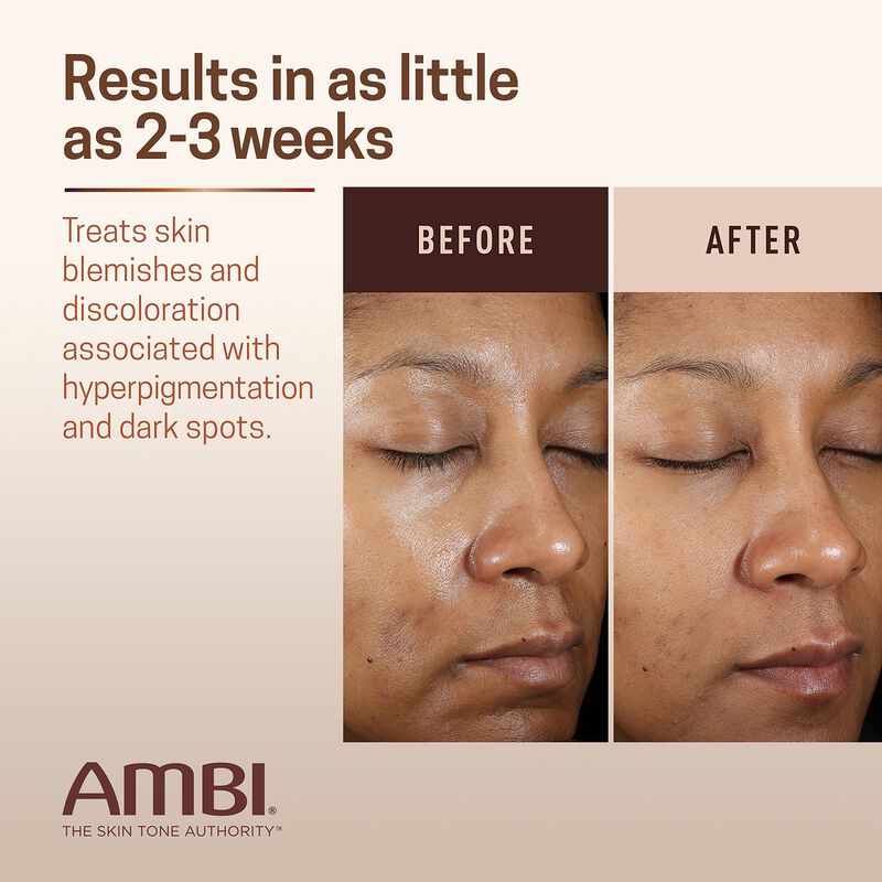 Crema Facial Ambi Even & Clear Advanced Para Hi... image number null