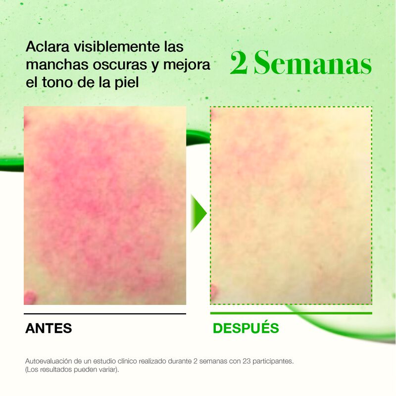 Anua Azelaic Acid 10 Hyaluron Redness Soothing ... image number null