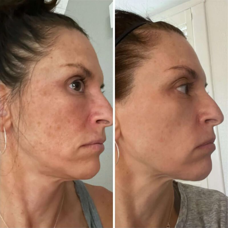 Exfoliante Facial Kiaeva 30 ml image number null