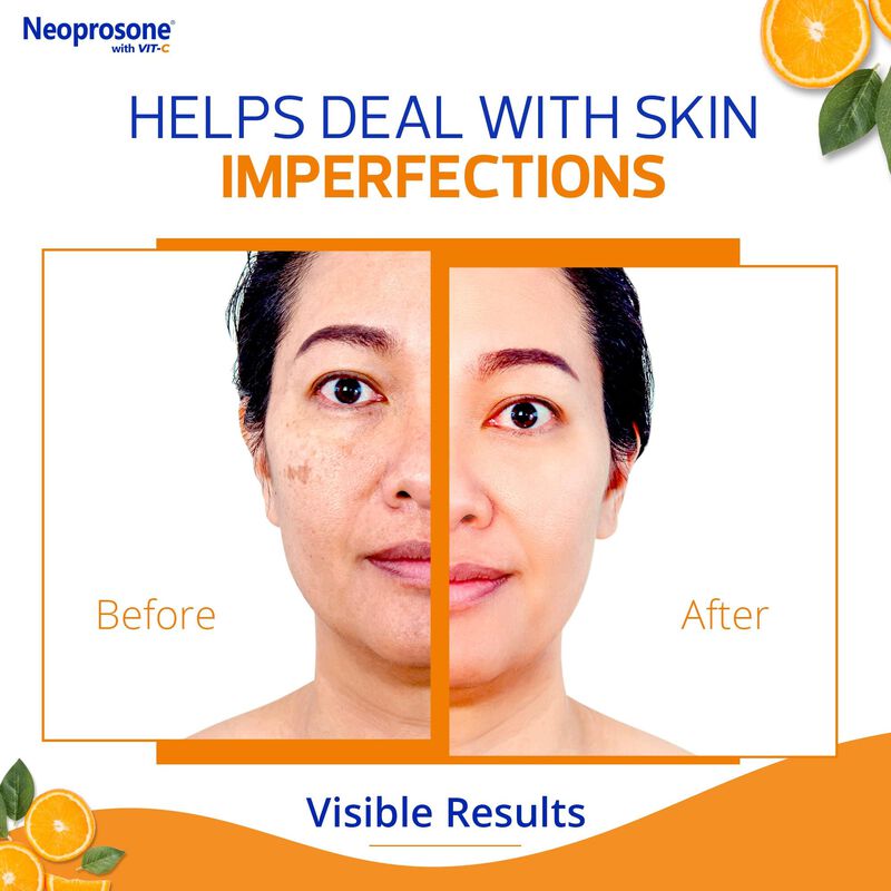 Crema Correctora De Manchas, Neoprosona, 20% Vi... image number null