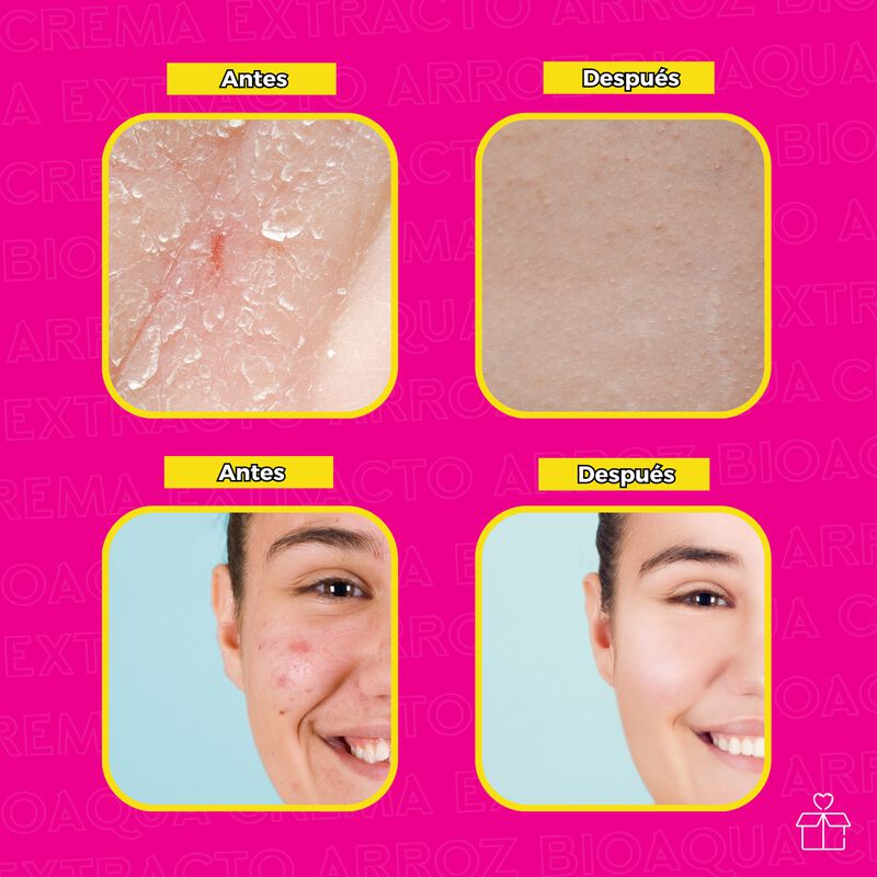 Set de 3 Cremas de Extracto Arroz Bioaqua &Aacute;cido... image number null