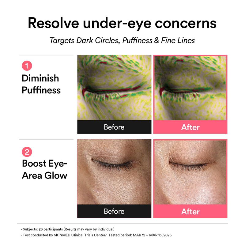 Parche para ojos Abib PDRN Retinal Glow Jelly 6... image number null