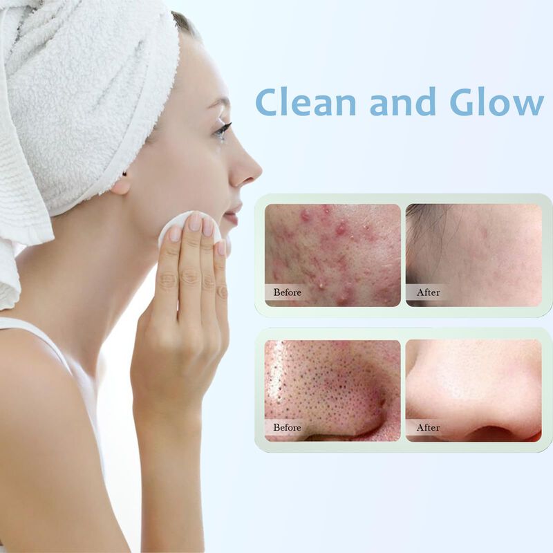 Pads Faciales Grospe 20% &Aacute;cido Glic&oacute;lico 60 Uni... image number null