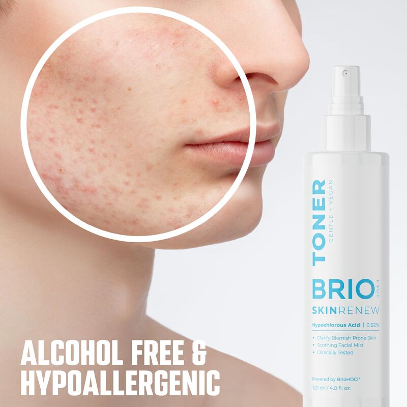 Skin Toner Briotech Skin Renew Con &Aacute;cido Hipocl... image number null