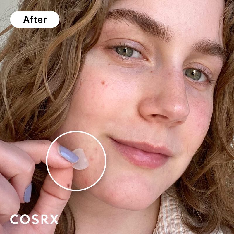 Pimple Patch Cosrx, Hidrocoloide Absorbente De ... image number null