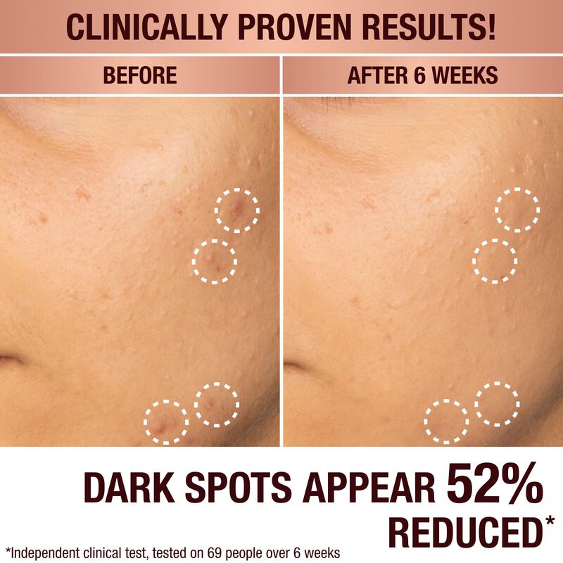 Suero Facial Radiance Recovery Charlotte Tilbur... image number null