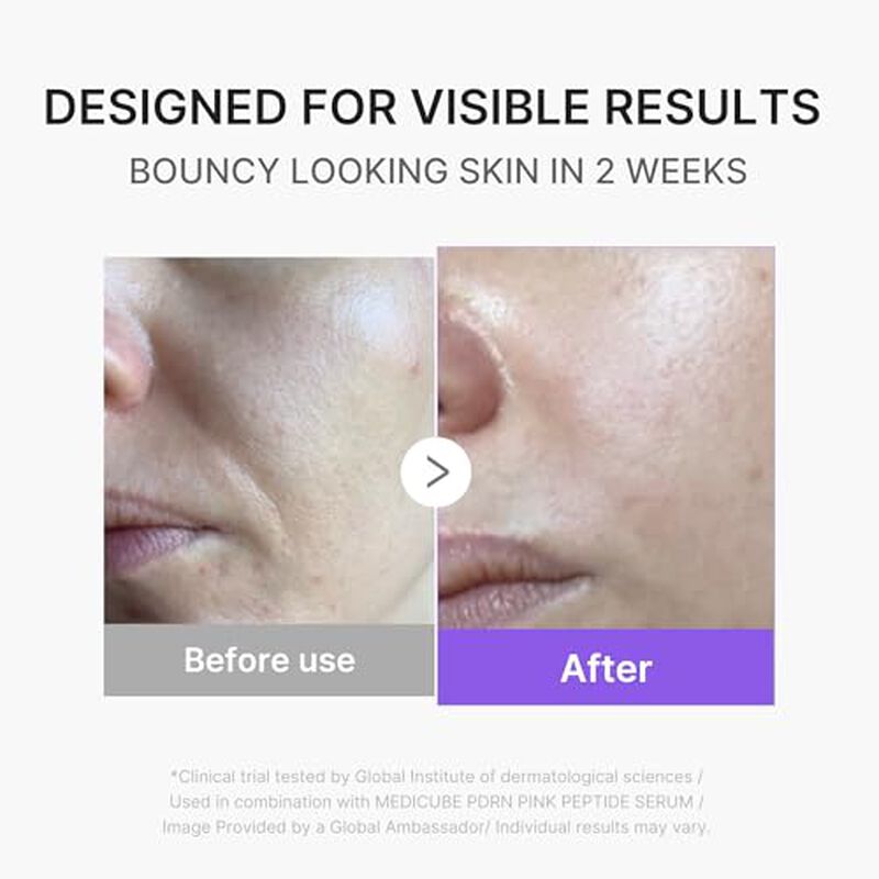 M&aacute;quina Facial Medicube Mini Booster Pro Plus R... image number null