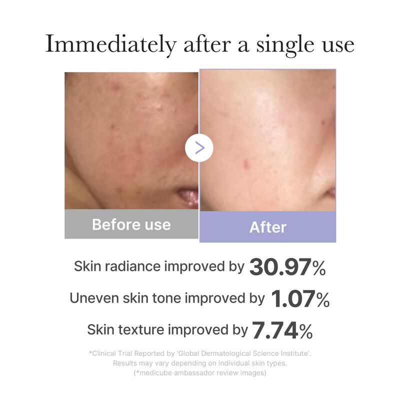 Herramienta Para El Cuidado De La Piel Facial M... image number null